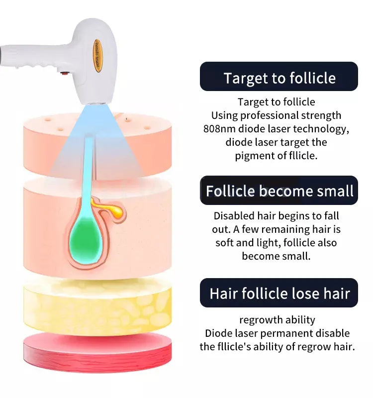 Newest 2000W 808nm diode l-aser 3 Wavelength 755 808 1064nm Hair Removal Machine Cooling Head Painless Epilator Face Body