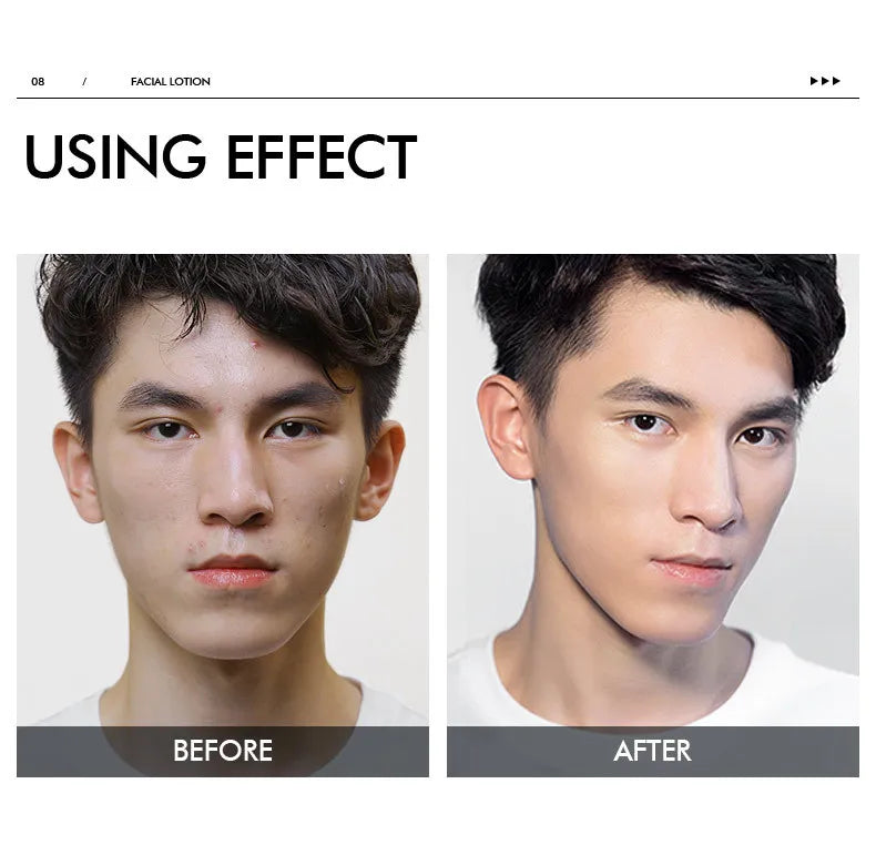 LAIKOU Face Lotion For Men Sensitive Skin Firming Cream Refreshing Moisturizin Men's Night Moisturizer Facial Skin Care Products