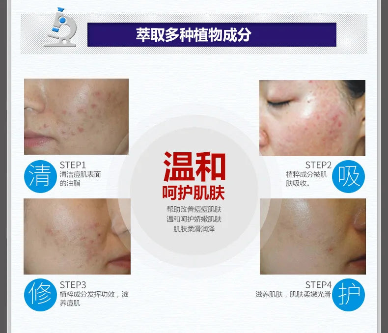 BIOAQUA Firming Skin Care Set Essence Firming Oil Control Refreshing Facial Cleanser Serum Face Care  Cream Set Skin Care