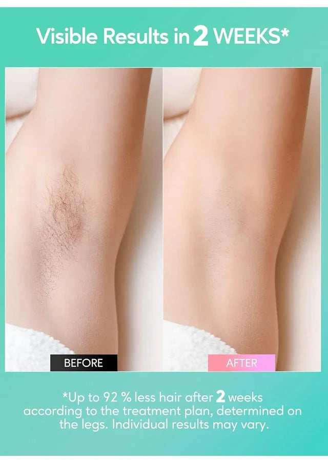 Permanent Laser Hair Removal Bikini Women's IPL Depilators Shaver Facial Hair Cutting Machine Men's Razo to Remove Hair Trimmer