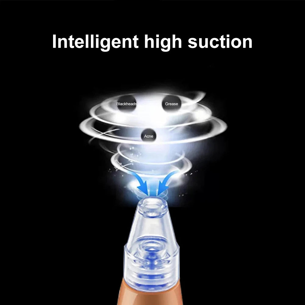 Electric Blackhead Remover & Pore Cleaner, Acne Treatment Facial Device with Skin-Tightening for Deep Cleansing Skincare Tools