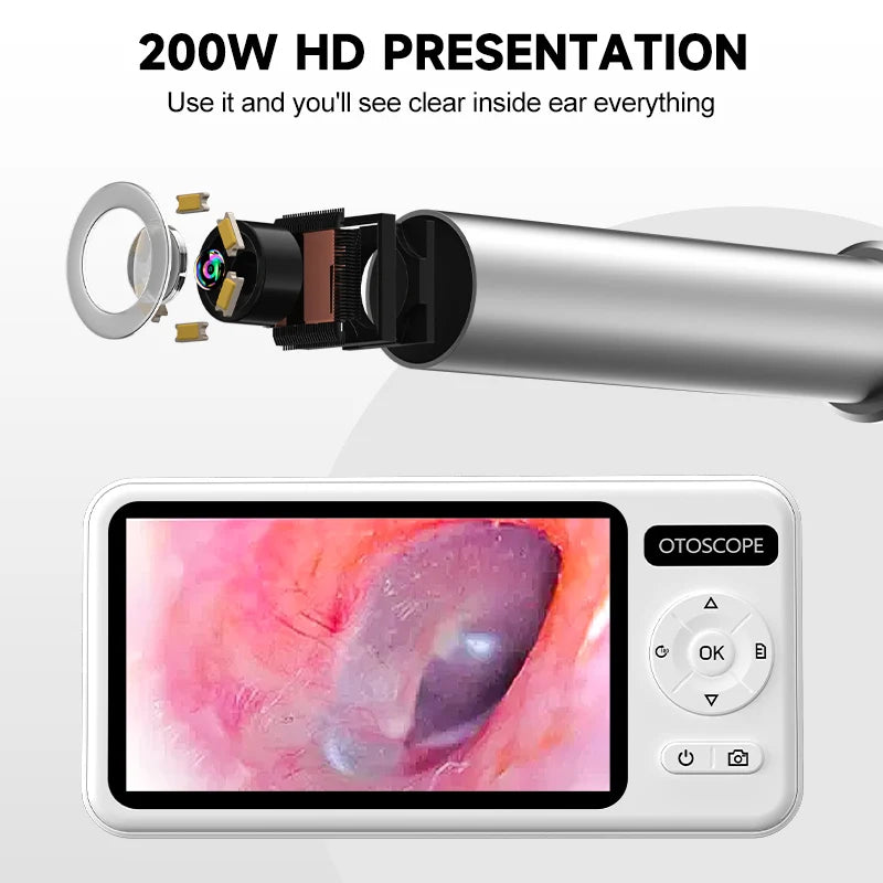 4.5 Inch Digital Otoscope HD1080P 3.9mm Ear Picker Ear Camera 6 LEDs Ear Wax Removal Tool Ear Cleaning Stick For Child Adults