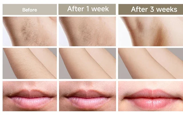 Permanent Laser Hair Removal Bikini Women's IPL Depilators Shaver Facial Hair Cutting Machine Men's Razo to Remove Hair Trimmer