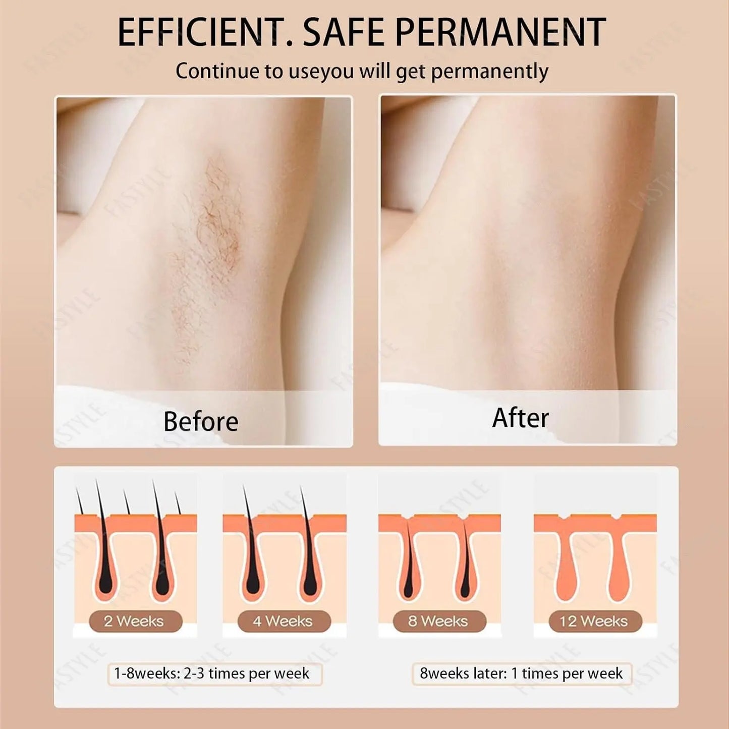 10  Beauty Care IPL Hair Removal Device 990000 Flashes Painless Permanent for Women Face Body Bikini LED Display Home Use