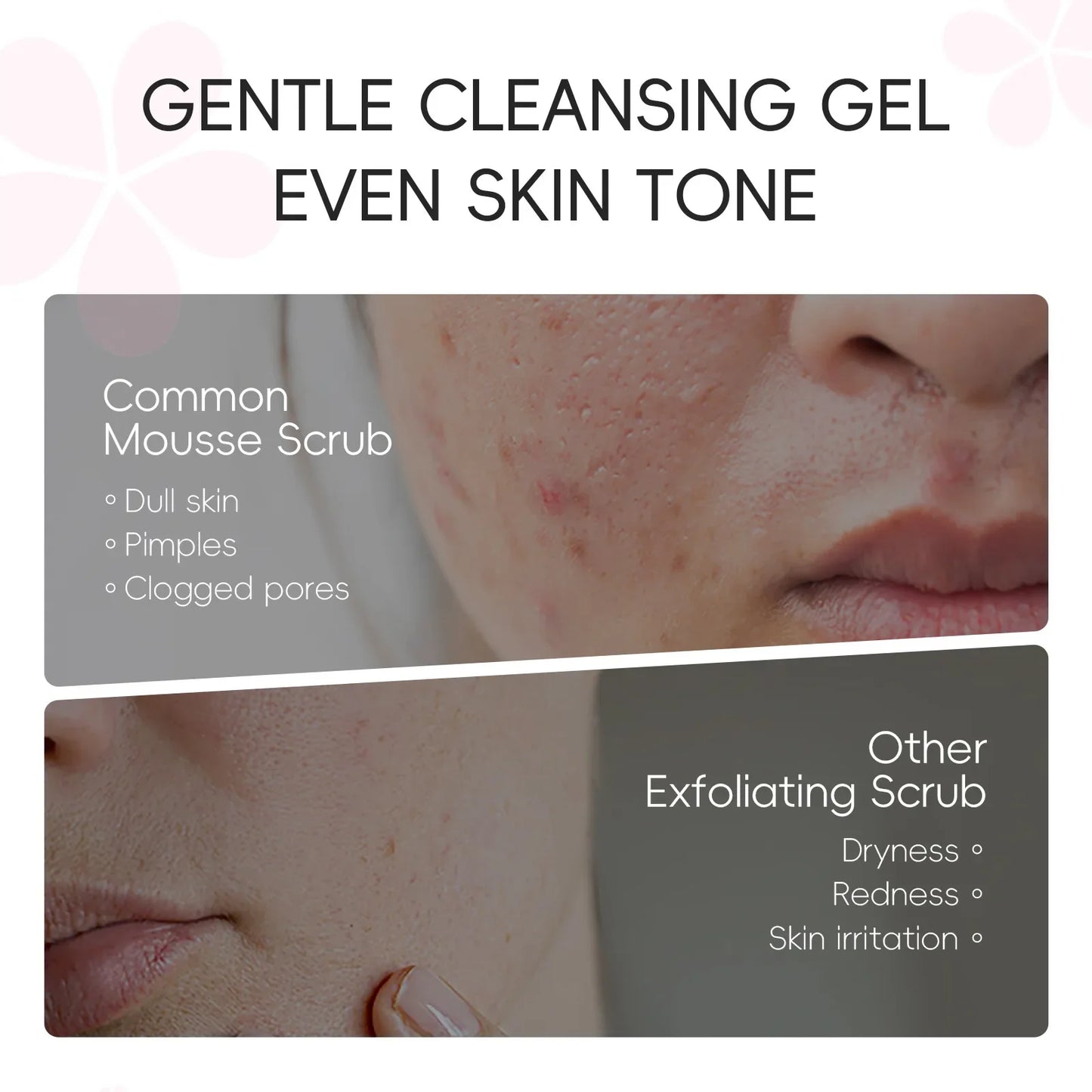 LAIKOU Sakura Face Peeling Gel Facial Exfoliation Cleans Pores Moisturizing Oil Control  Facial Scrub Skin Care 60g