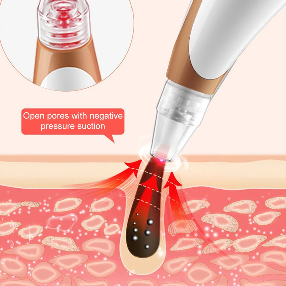 Electric Blackhead Remover & Pore Cleaner, Acne Treatment Facial Device with Skin-Tightening for Deep Cleansing Skincare Tools