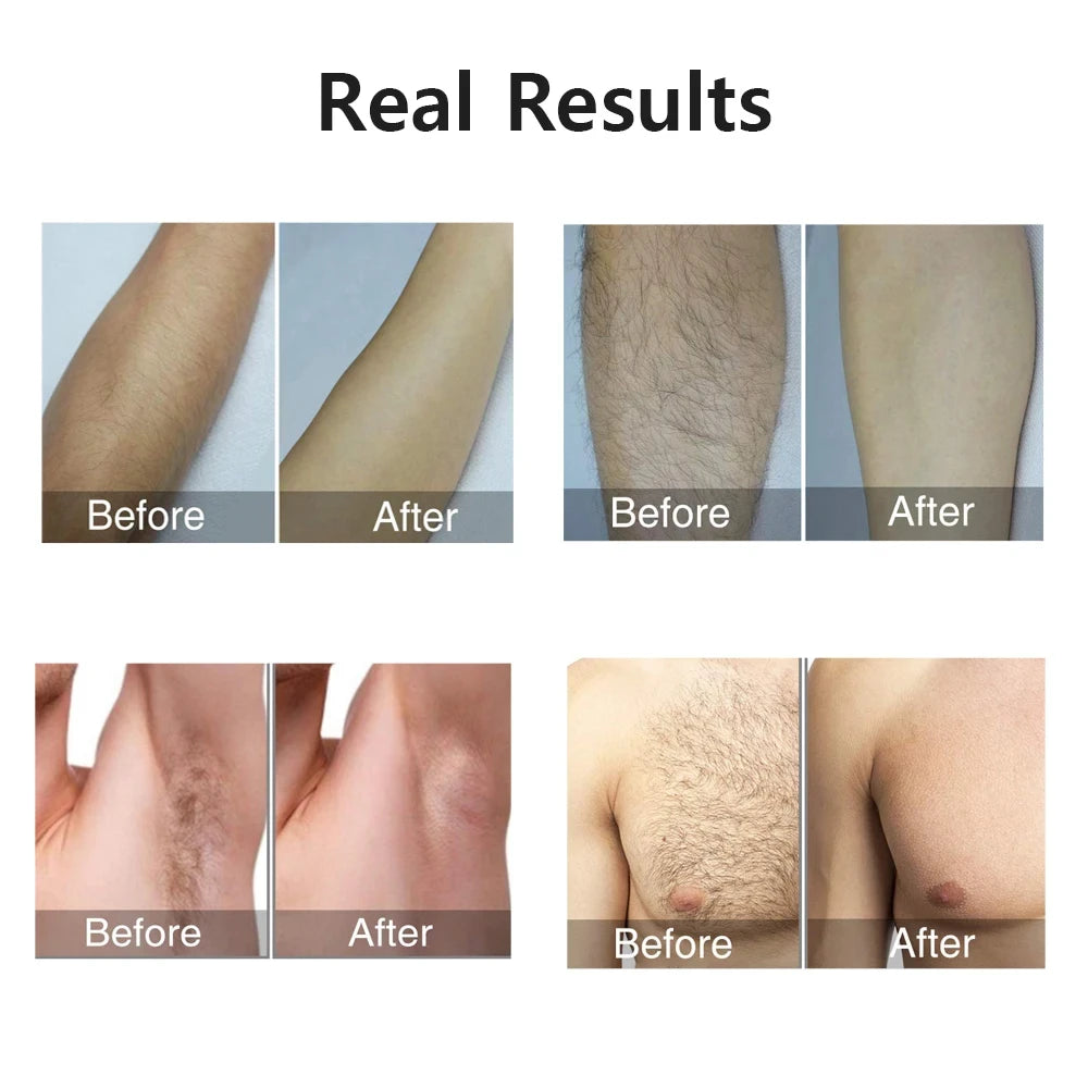 10   IPL Hair Removal Device 990000 Flashes Painless Permanent for Women Face Body Bikini Home Use LED Display