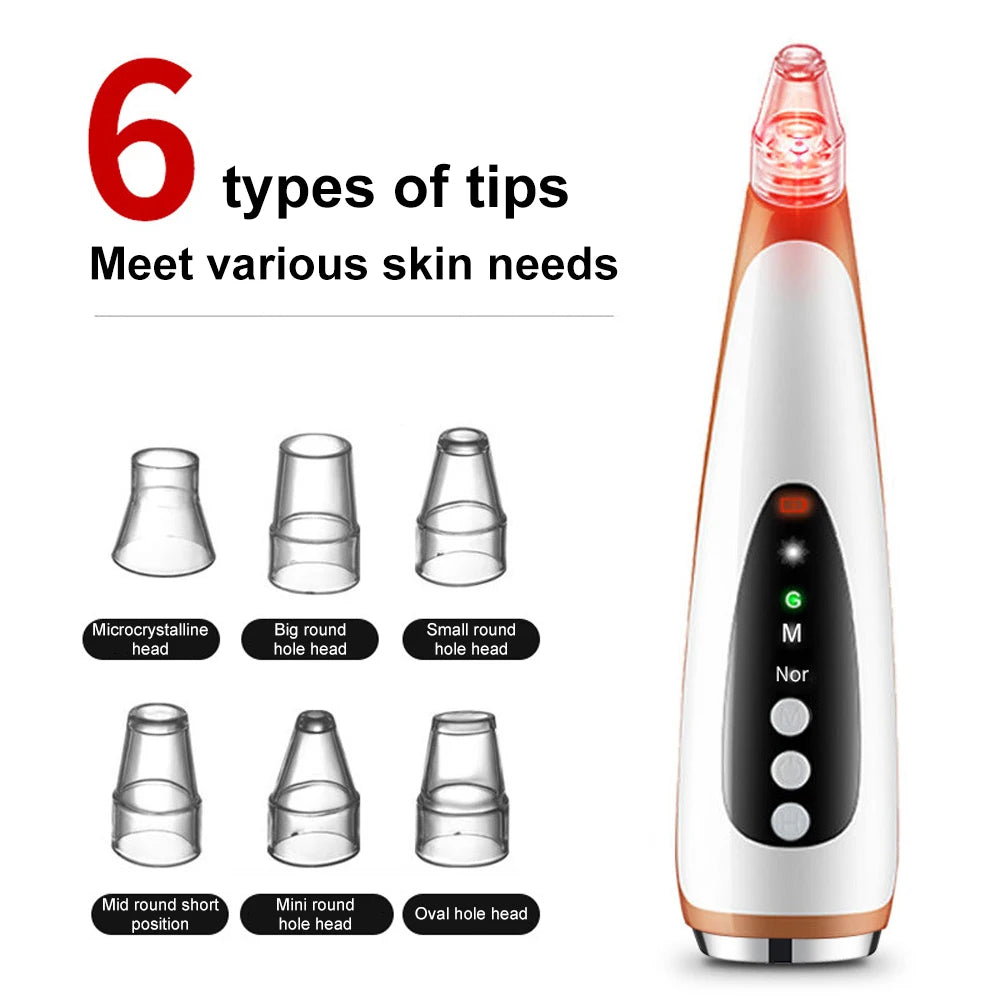 Electric Blackhead Remover & Pore Cleaner, Acne Treatment Facial Device with Skin-Tightening for Deep Cleansing Skincare Tools
