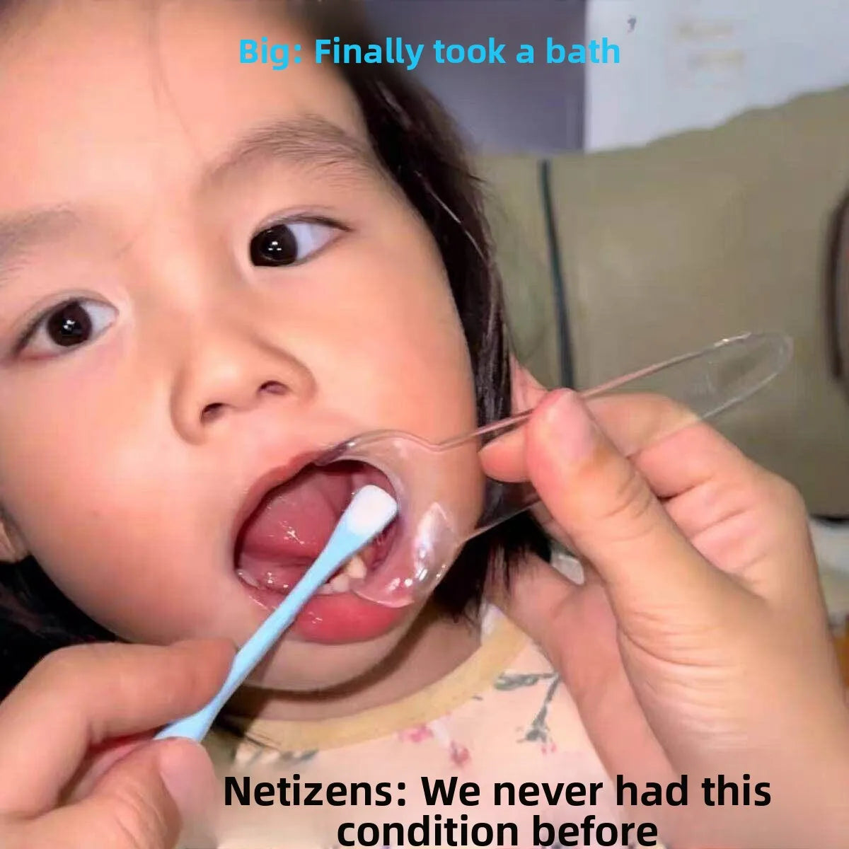 Baby Toothbrushing Tool Child Oral Opening Device Assisted Cleaning Small Device for Teeth Dirt Cleaning Home Daily Use