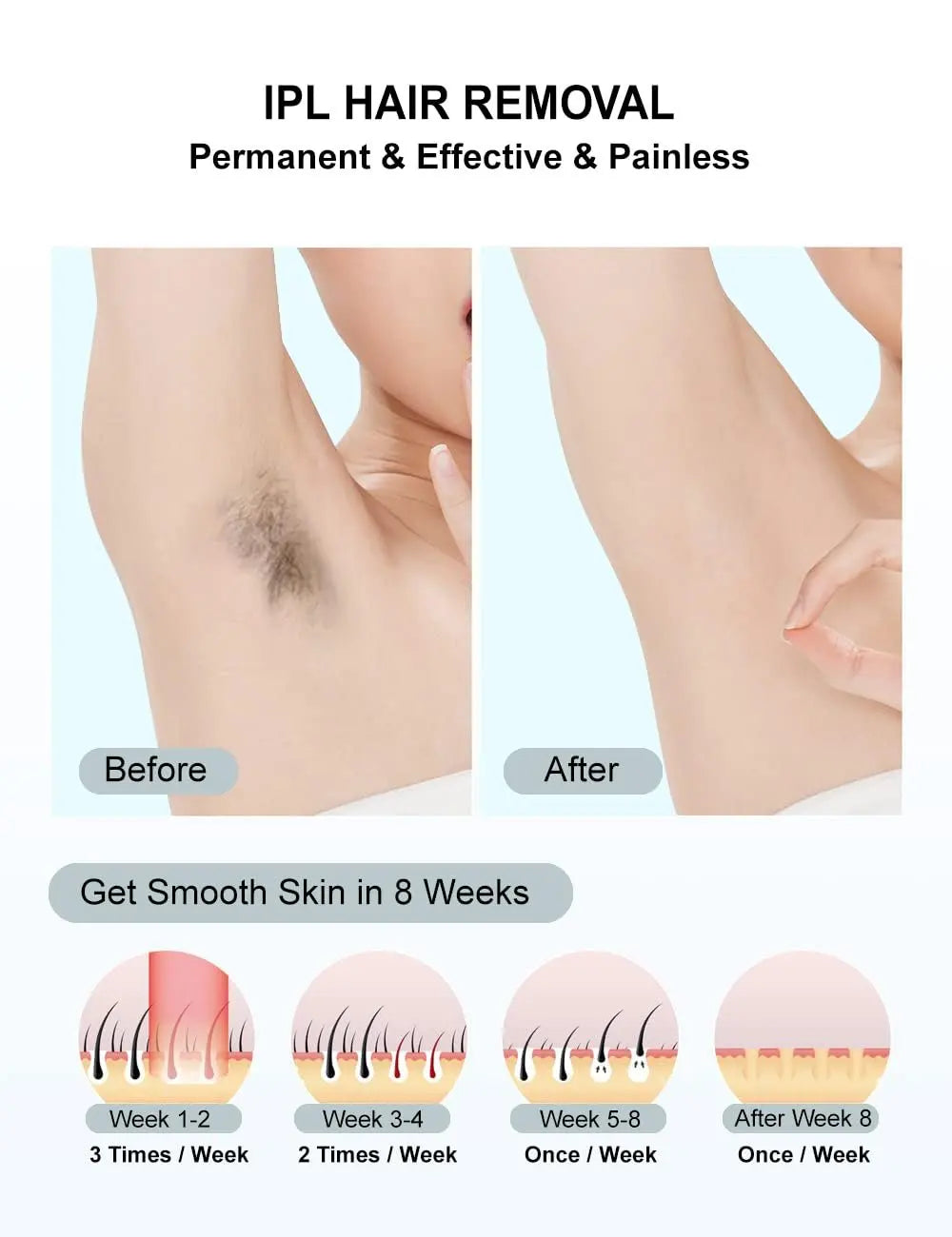 IPL Hair Removal Device 990,000 Flashes – Permanent & Painless | Face, Body & Bikini | 5 Levels | Home Use