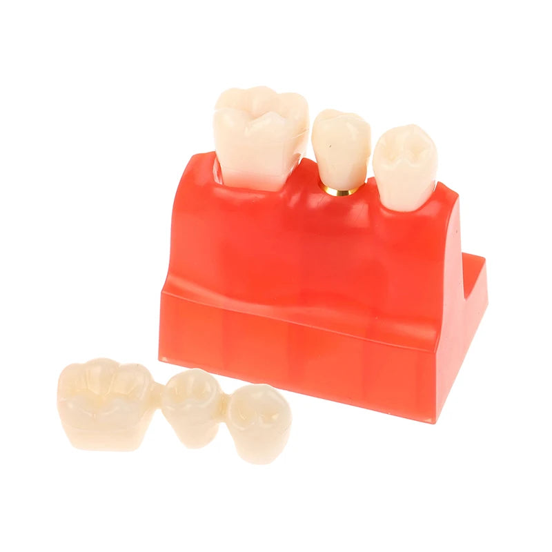 Dental 4 Times Implant Teeth Model Analysis Crown Bridge Demonstration Removable Model Dentistry Study Training Teaching Model
