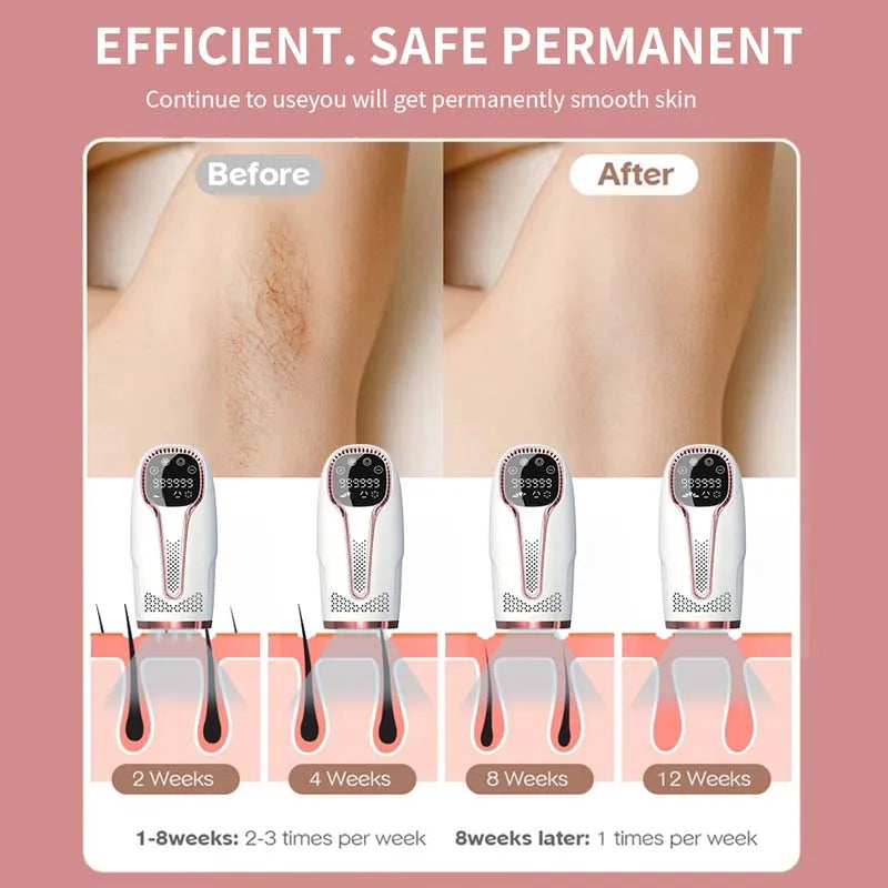 Professional Permanent Hair Removal Ipl Machine Cheap 9 Gear Laser Ipl Customized Flashes 999,999 Remove Hair for Women Man