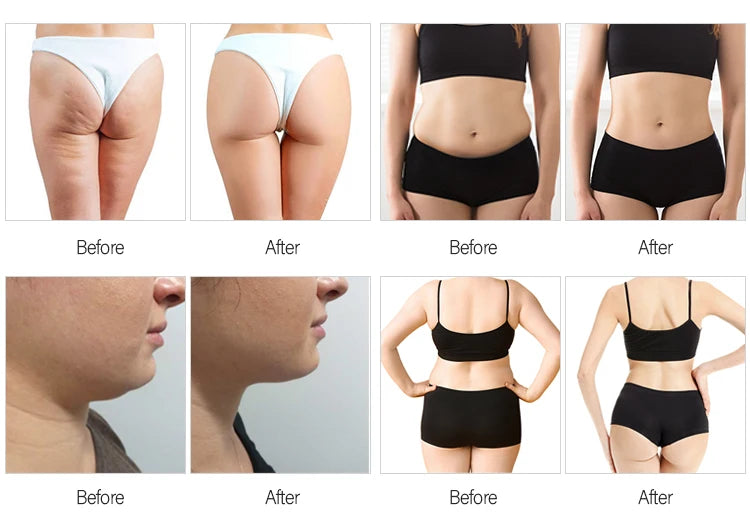 2025 Newest Big Mechanical Vacuum Roller Slim Strong Cleaning System 3in1 Vela Body Shape Machine V8