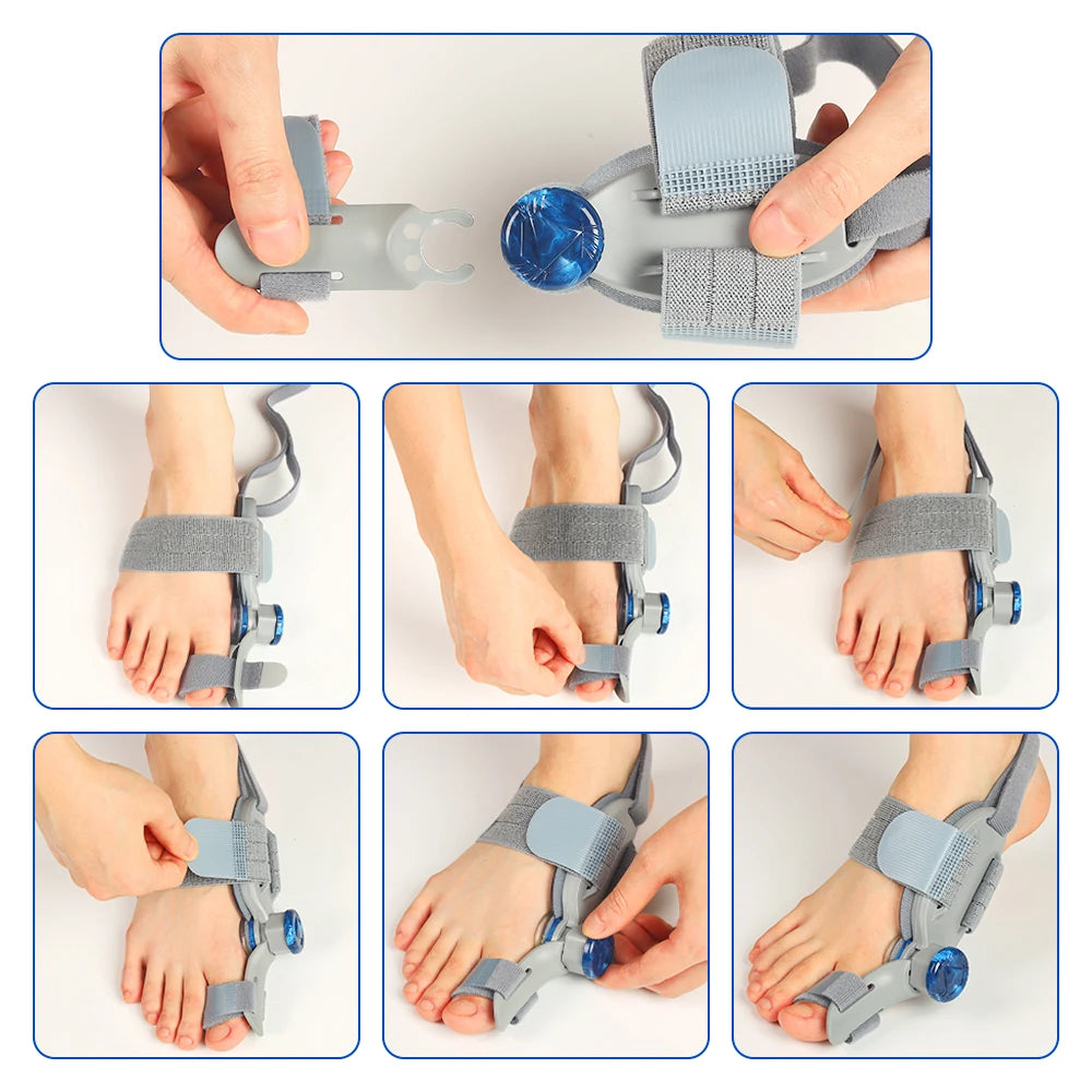 Bunion Adjuster Knob Adjustable Foot Hallux Valgus Braces Toe Straightener Pedicure Finger Toe Adjuster Unisex