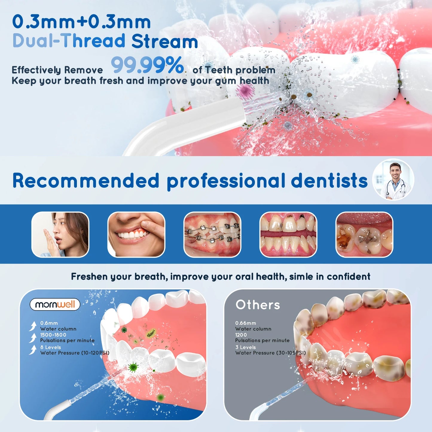 Water Dental Flosser Cordless Oral Irrigator with 300ml 5 Tips 4 Modes USB Charger Portable Travle Irrigation Dental Cleaner