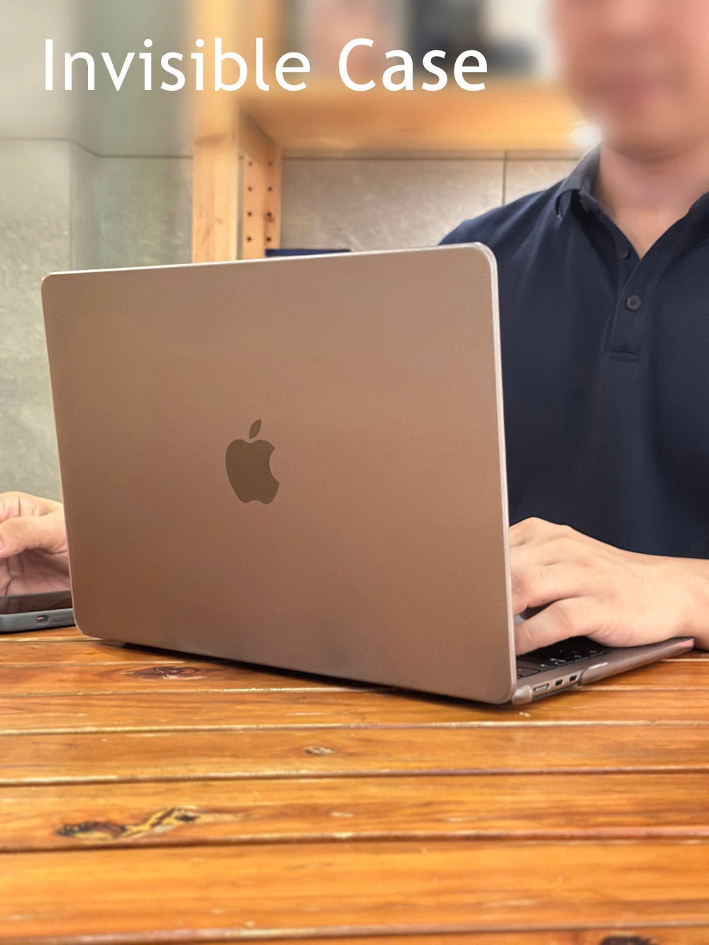 Invisible Laptop Case for Macbook Air 13 Case M1 M2 M3 M4 Pro 14 16  Funda Para Air 15 Pulgadas Advanced Laptop Shell