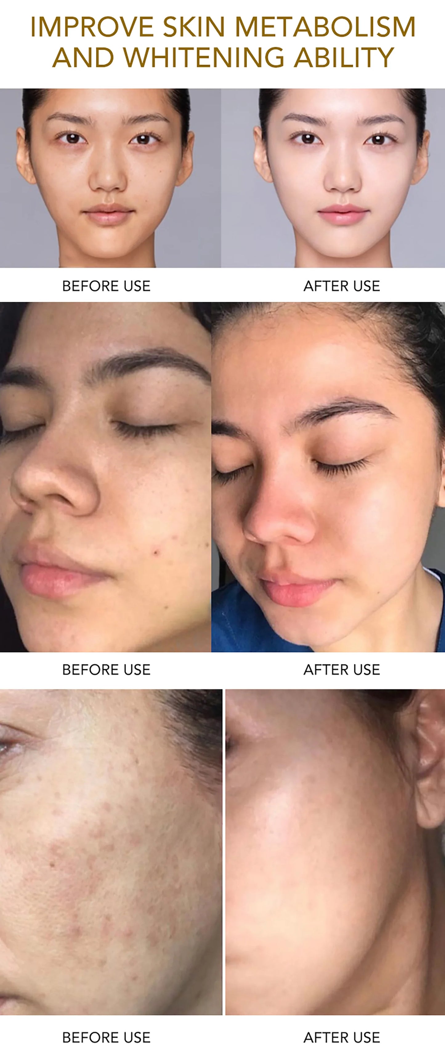 AILKE Whitening Skin Care Set, Reduce Wrinkles, Dark Spots, Even Skin Tone, Women Beauty Cosmetics for All Skin Types