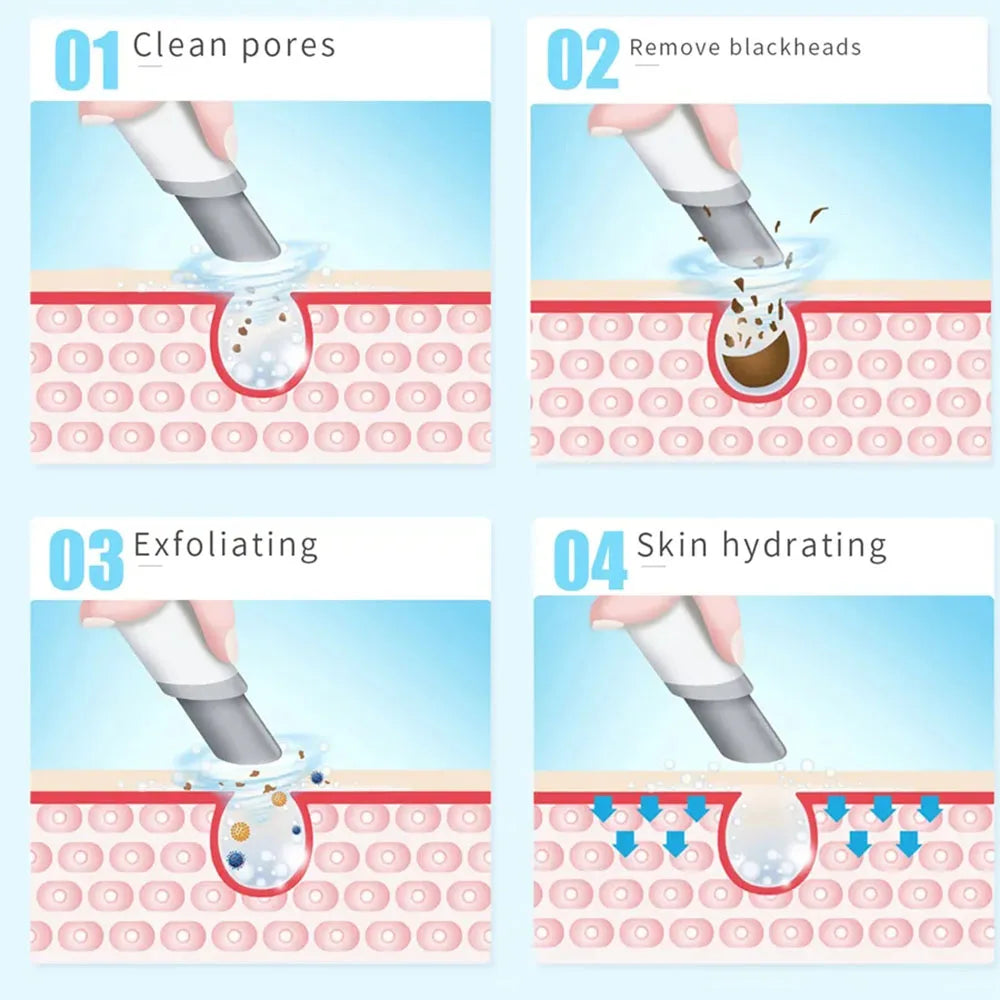 Peeling Beauty Device New Small Bubble Oxygen Injection Instrument Hydra Dermabrasion Aqua Facial Cleaning Suction Blackhead