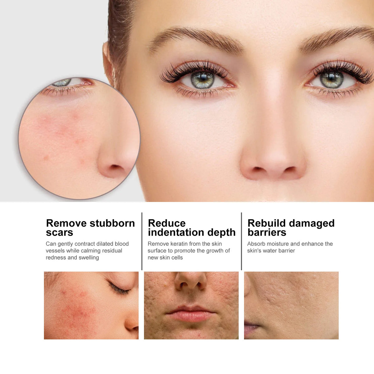 Nicotinamide Whitening Serum Lighten Acne Marks Shrinking Pores Improve Roughness Skin Brightening Moisturizing Facial Essence