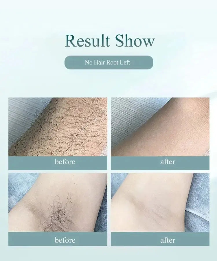 10  Beauty Care IPL Hair Removal Device 990000 Flashes Painless Permanent for Women Face Body Bikini LED Display Home Use
