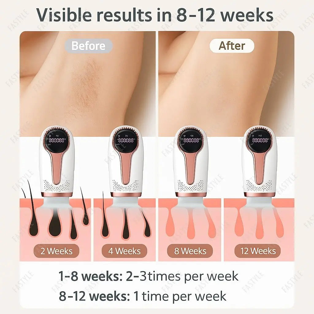 IPL Hair Removal Device 990,000 Flashes – Permanent & Painless | Face, Body & Bikini | 5 Levels | Home Use