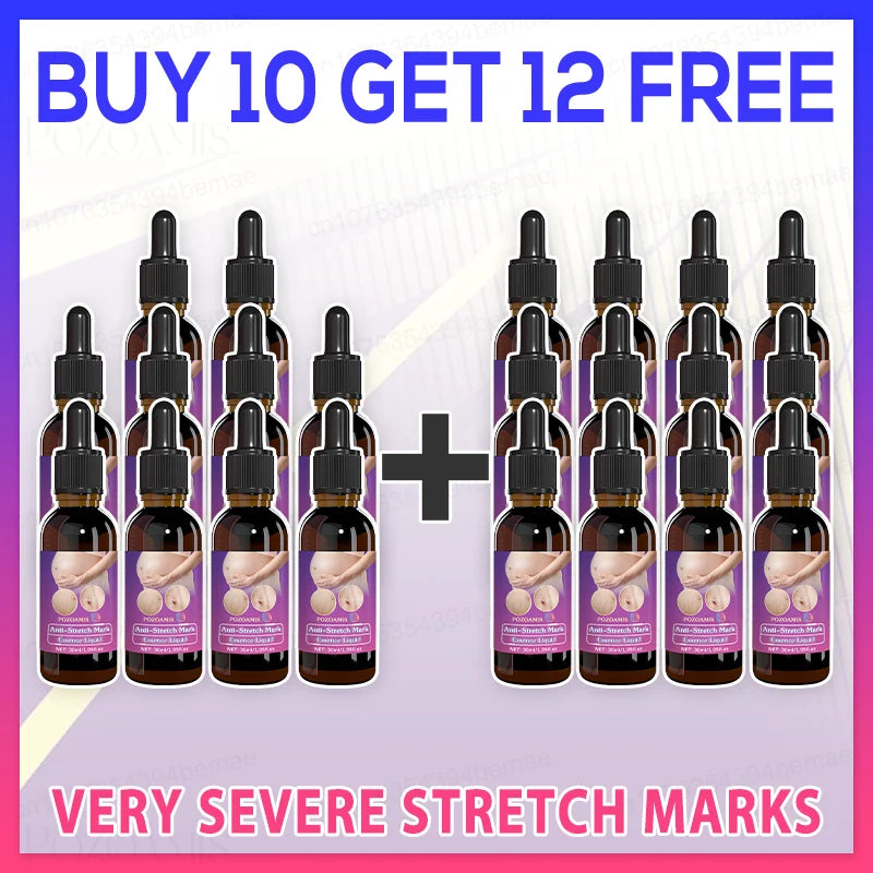 Choose the right product to make stretch marks invisible!