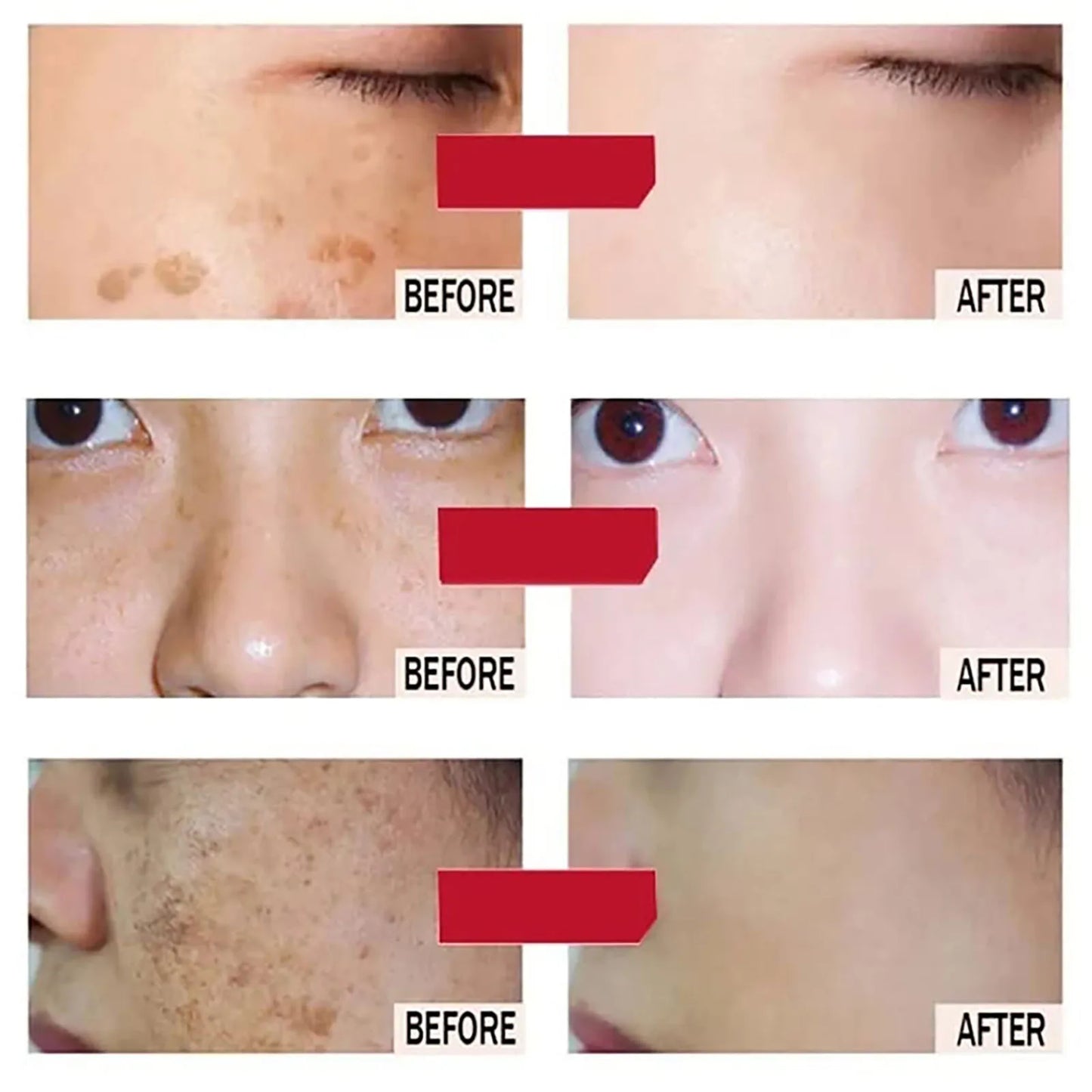 AILKE Whitening Skin Care Set, Reduce Wrinkles, Dark Spots, Even Skin Tone, Women Beauty Cosmetics for All Skin Types