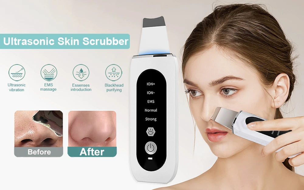 Ultrasonic Skin Scrubber Facial Peeling Machine Face Scrubber Acne Pore Deep Cleaning Facial Cleaning Spatula Blackhead Remover