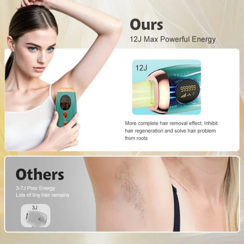 Home-use painless female hair removal device with permanent installation - portable Ipl laser hair removal machine
